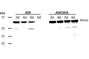 Western Blotting (WB) image for anti-Phosducin (PDC) antibody (ABIN619539) (Phosducin 抗体)