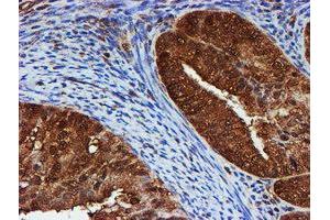 Image no. 7 for anti-Proteasome (Prosome, Macropain) Subunit, beta Type, 9 (Large Multifunctional Peptidase 2) (PSMB9) (AA 21-219) antibody (ABIN1491194)