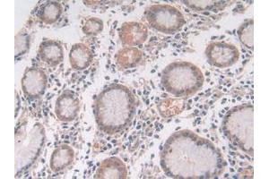 IHC-P analysis of Human Stomach Tissue, with DAB staining. (Utrophin 抗体  (AA 1-252))