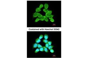 ICC/IF Image Immunofluorescence analysis of methanol-fixed A431, using LARS2, antibody at 1:200 dilution. (LARS2 抗体)