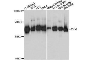 Western blot analysis of extracts of various cell lines, using PKM antibody. (PKM 抗体  (AA 11-221))
