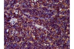 IHC image of ABIN7147311 diluted at 1:400 and staining in paraffin-embedded human lymph node tissue performed on a Leica BondTM system. (CDCA7L 抗体  (AA 14-167))