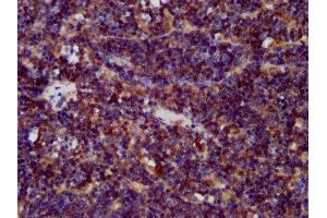 IHC image of ABIN7147311 diluted at 1:400 and staining in paraffin-embedded human lymph node tissue performed on a Leica BondTM system. (CDCA7L 抗体  (AA 14-167))