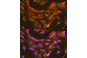 Immunofluorescence analysis of C6 cells using PDI Rabbit mAb (ABIN7269615) at dilution of 1:100 (40x lens). (PDIA6 抗体)