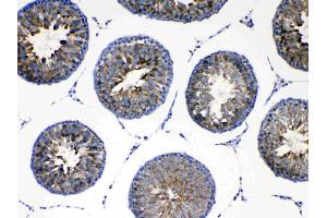 IHC analysis of AGRP using anti-AGRP antibody . (AGRP 抗体  (AA 82-131))