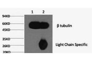 1) Input: Mouse brain tissue, 2) IP product: IP at dilution of 1: 200 (TUBB 抗体)