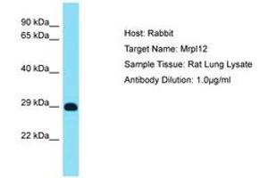 Image no. 1 for anti-Mitochondrial Ribosomal Protein L12 (MRPL12) (AA 119-168) antibody (ABIN6750517) (MRPL12 抗体  (AA 119-168))