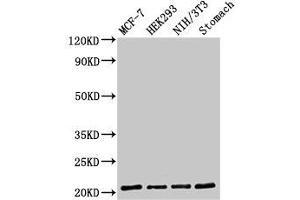 Western Blot Positive WB detected in: MCF-7 whole cell lysate, HEK293 whole cell lysate, NIH/3T3 whole cell lysate, Rat stomach tissue All lanes: CD3G antibody at 2 μg/mL Secondary Goat polyclonal to rabbit IgG at 1/50000 dilution Predicted band size: 21 kDa Observed band size: 21 kDa (CD3G 抗体  (AA 138-182))