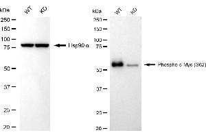 Western blotting analysis using phospho-c-Myc (S62) antibody (ABIN7799503). (Recombinant c-MYC 抗体  (pSer62))