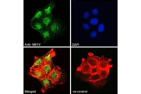 MEFV 抗体  (Internal Region)