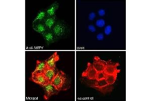 ABIN185451 Immunofluorescence analysis of paraformaldehyde fixed A431 cells, permeabilized with 0. (MEFV 抗体  (Internal Region))