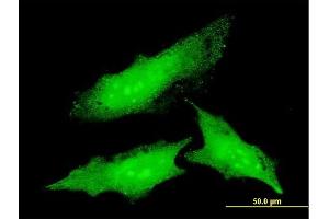 Immunofluorescence of monoclonal antibody to ODC1 on HeLa cell. (ODC1 抗体  (AA 1-461))