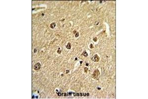 Immunohistochemistry (Paraffin-embedded Sections) (IHC (p)) image for anti-Metastasis Associated 1 Family, Member 2 (MTA2) (AA 516-544), (C-Term) antibody (ABIN390610)