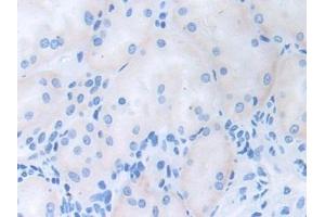 Detection of CDCP1 in Human Kidney Tissue using Polyclonal Antibody to CUB Domain Containing Protein 1 (CDCP1) (CDCP1 抗体  (AA 689-836))