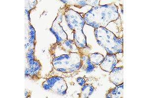 Immunohistochemistry of paraffin-embedded human placenta using [KO Validated] PD-L1/CD274 Rabbit mAb (ABIN7266178) at dilution of 1:100 (40x lens). (PD-L1 抗体)