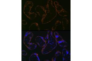 Immunofluorescence (IF) image for anti-Cytochrome P450, Family 26, Subfamily A, Polypeptide 1 (CYP26A1) antibody (ABIN7266654)