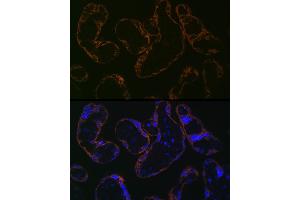Immunofluorescence analysis of human placenta cells using CYP26 Rabbit mAb (ABIN7266654) at dilution of 1:100 (40x lens). (CYP26A1 抗体)