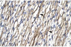 Rabbit Anti-RBM10 Antibody  Paraffin Embedded Tissue: Human Heart Cellular Data: Myocardial cells Antibody Concentration: 4.