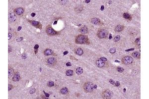 Paraformaldehyde-fixed, paraffin embedded mouse brain, Antigen retrieval by boiling in sodium citrate buffer (pH6) for 15min, Block endogenous peroxidase by 3% hydrogen peroxide for 30 minutes, Blocking buffer (normal goat serum) at 37°C for 20min, Antibody incubation with RNF128 Polyclonal Antibody (bs-9251R) at 1:400 overnight at 4°C, followed by a conjugated secondary and DAB staining. (RNF128 抗体)