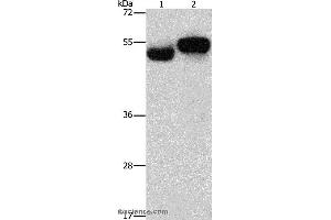 Western blot analysis of Human fetal brain and liver tissue, using AMZ1 Polyclonal Antibody at dilution of 1:1000 (AMZ1 抗体)