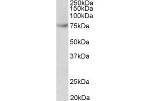 Western Blotting (WB) image for anti-Far Upstream Element (FUSE) Binding Protein 1 (FUBP1) (AA 160-174) antibody (ABIN5900708) (FUBP1 抗体  (AA 160-174))