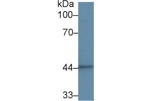 Western blot analysis of Human A431 cell lysate, using Human KRT15 Antibody (2 µg/ml) and HRP-conjugated Goat Anti-Rabbit antibody ( (KRT15 抗体  (AA 105-411))