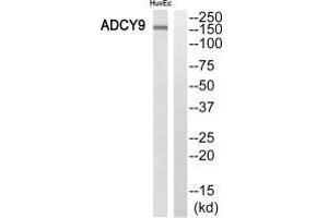 Western blot analysis of extracts from HuvEc cells, using ADCY9 antibody. (ADCY9 抗体  (N-Term))
