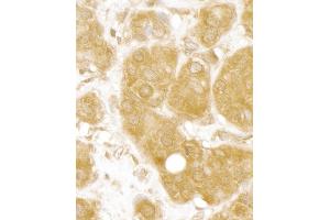 Immunohistochemistry (IHC) image for anti-BRISC and BRCA1 A Complex Member 1 (BABAM1) (AA 175-225) antibody (ABIN7454455)