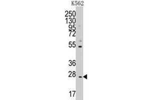 Western blot analysis of CD8B polyclonal antibody  in K-562 cell line lysates (35 ug/lane). (CD8B 抗体  (N-Term))