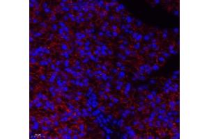 Immunofluorescence (Paraffin-embedded Sections) (IF (p)) image for anti-Aldehyde Dehydrogenase 4 Family, Member A1 (ALDH4A1) antibody (ABIN7073000)