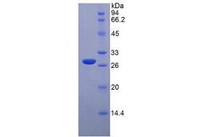 SDS-PAGE analysis of Rat Tafazzin Protein. (TAZ 蛋白)