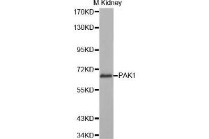 Western Blotting (WB) image for anti-P21-Activated Kinase 1 (PAK1) (AA 1-240) antibody (ABIN3023361) (PAK1 抗体  (AA 1-240))
