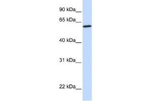 WB Suggested Anti-CYP27A1 Antibody Titration: 0. (CYP27A1 抗体  (Middle Region))