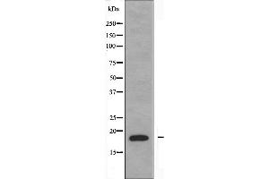 Western blot analysis of extracts from Jurkat cells using NBL1 antibody. (NBL1 抗体  (C-Term))
