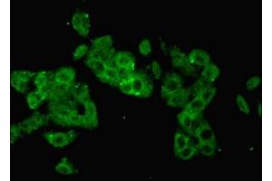 Immunofluorescent analysis of HepG2 cells using ABIN7157384 at dilution of 1:100 and Alexa Fluor 488-congugated AffiniPure Goat Anti-Rabbit IgG(H+L) (KRT14 抗体  (AA 1-472))