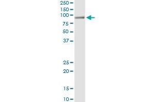 Immunoprecipitation of HAL transfected lysate using anti-HAL monoclonal antibody and Protein A Magnetic Bead , and immunoblotted with HAL MaxPab rabbit polyclonal antibody. (HAL 抗体  (AA 558-658))