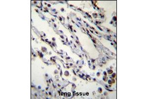 HIST1H2BN Antibdy (N-term) (ABIN657039 and ABIN2846210) immunohistochemistry analysis in formalin fixed and paraffin embedded human lung tissue followed by peroxidase conjugation of the secondary antibody and DAB staining.