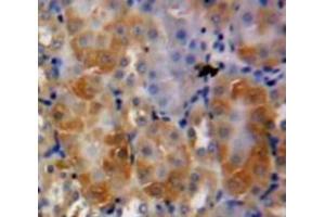 IHC-P analysis of Kidney tissue, with DAB staining. (Midkine 抗体  (AA 22-143))