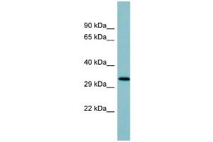 WB Suggested Anti-SFTPD Antibody Titration:  0. (SFTPD 抗体  (Middle Region))