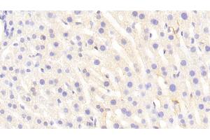 Detection of VCAM1 in Mouse Liver Tissue using Polyclonal Antibody to Vascular Cell Adhesion Molecule 1 (VCAM1) (VCAM1 抗体  (AA 511-682))