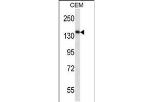 Western blot analysis in CEM cell line lysates (35ug/lane). (AATK 抗体  (N-Term))