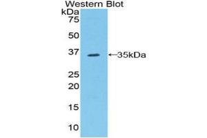 Detection of Recombinant Raftlin, Mouse using Polyclonal Antibody to Raft Linking Protein (Raftlin)