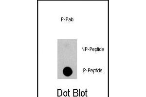 Dot blot analysis of anti-EGFR-p Phospho-specific Pab (ABIN1944845 and ABIN2839700) on nitrocellulose membrane. (EGFR 抗体  (pSer1070))