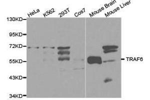 Western Blotting (WB) image for anti-TNF Receptor-Associated Factor 6 (TRAF6) antibody (ABIN1875195) (TRAF6 抗体)