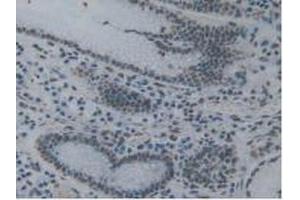 IHC-P analysis of Human Stomach Tissue, with DAB staining. (TOR1A 抗体  (AA 33-321))