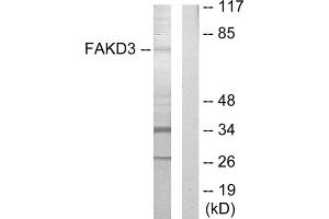 Western blot analysis of extracts from HepG2 cells, using FAKD3 antibody. (FASTKD3 抗体  (Internal Region))