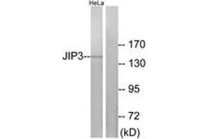 Western blot analysis of extracts from HeLa cells, using JIP3 Antibody. (JIP3 抗体  (AA 621-670))