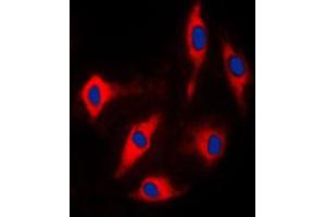 Immunofluorescent analysis of ARHGAP17 staining in Lovo cells. (ARHGAP17 抗体  (Center))