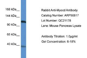 WB Suggested Anti-Myocd Antibody   Titration: 1. (Myocardin 抗体  (N-Term))