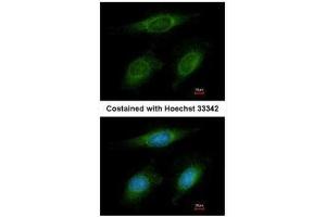 ICC/IF Image Immunofluorescence analysis of methanol-fixed HeLa, using RNF6, antibody at 1:200 dilution. (RNF6 抗体  (C-Term))